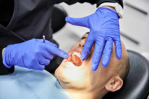 Best Broken or Cracked Tooth Emergency Dentist in Marmora, NJ